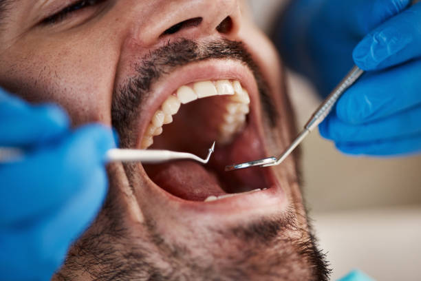 Best Chipped Tooth Repair Near Me  in Lebanon South, PA